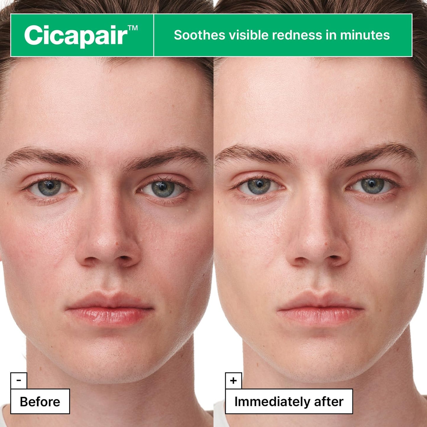 Dr. Jart+ Cicapair Intensive Soothing Repair Serum Mask 25g – Calming Cica Sheet Mask for Sensitive Skin