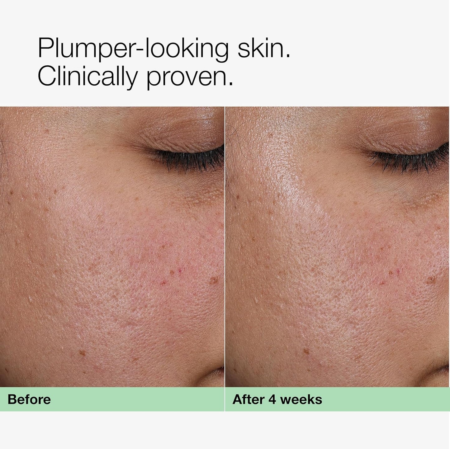 Clinique Smart Clinical Repair Collagen + PDRN Cream | Firming Moisturizer