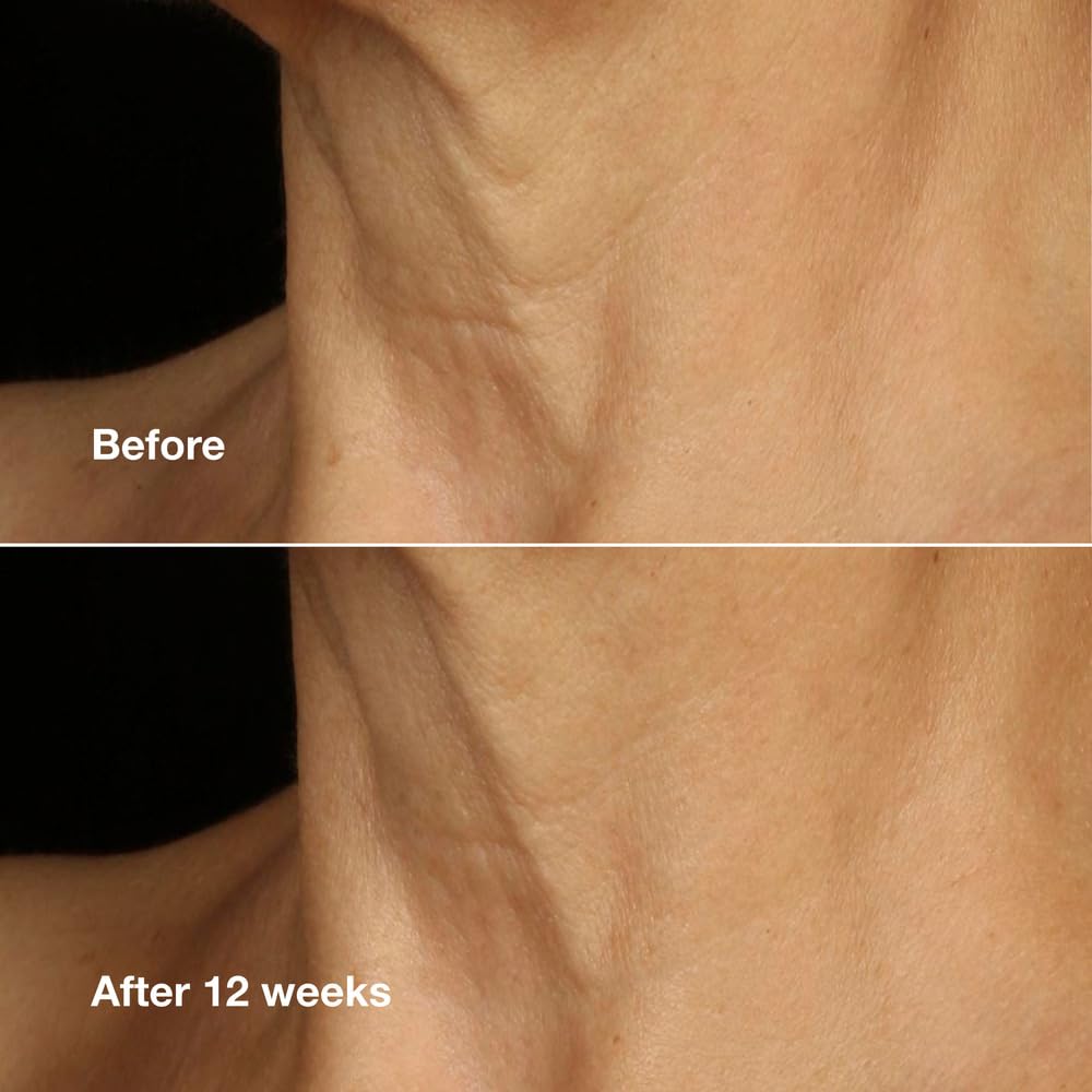 Clinique Smart Clinical Repair Face + Neck Cream | Lift