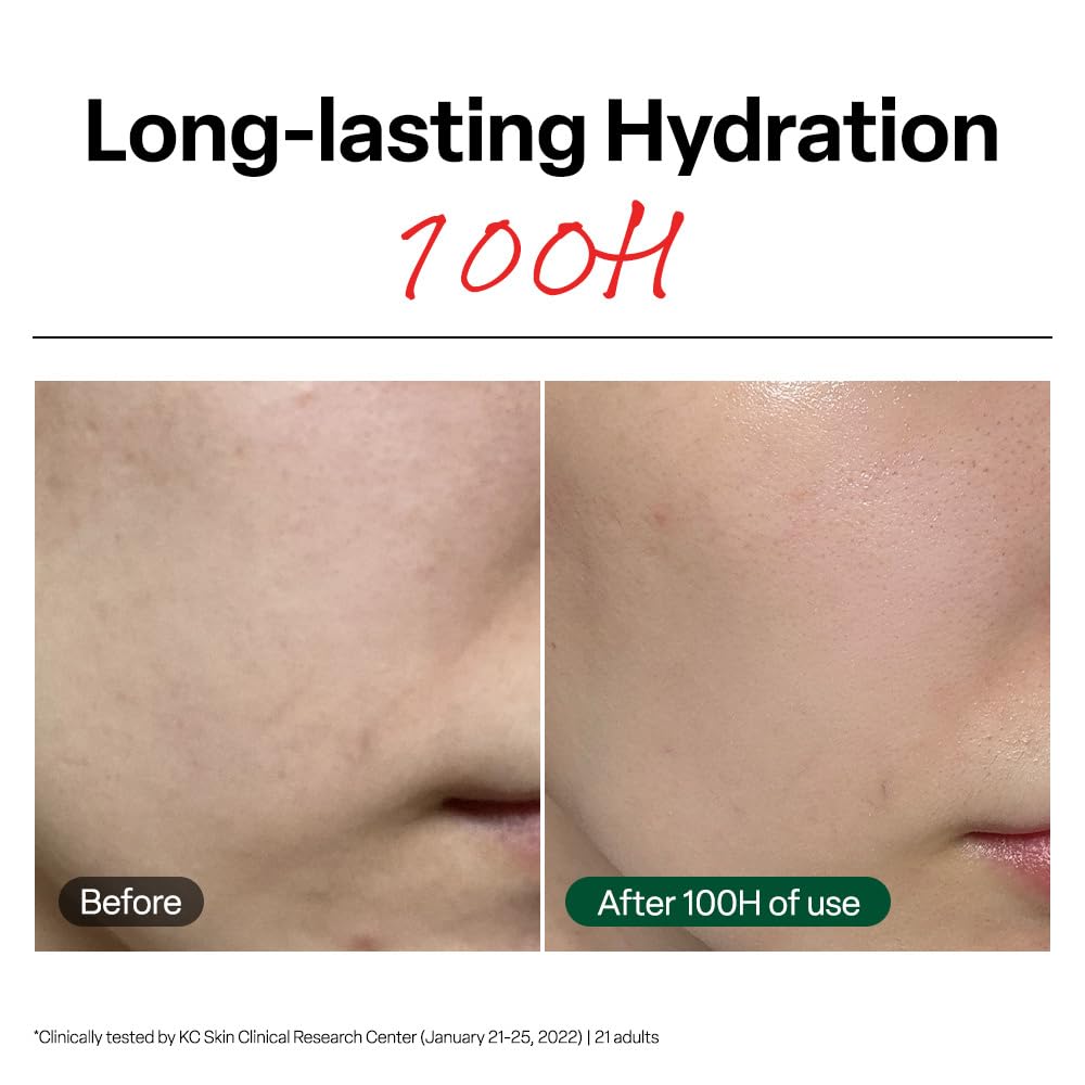 Dr. G R.E.D Blemish Clear Soothing Cream 50ml – Calming Moisturizer for Sensitive & Oily Skin