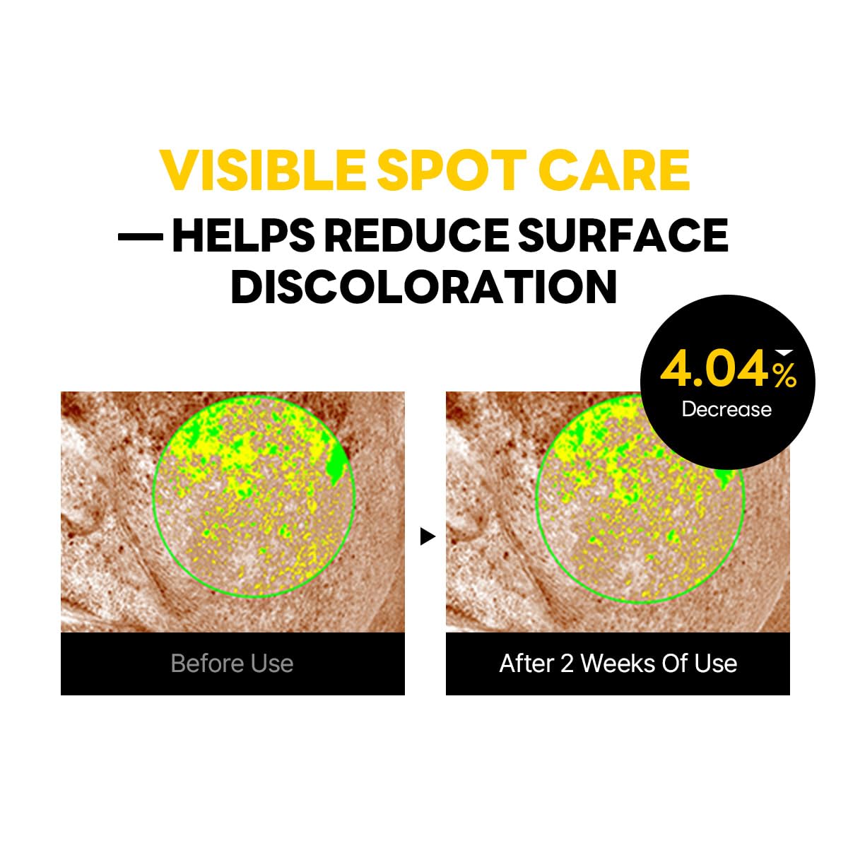 Round Lab Vita Niacinamide Dark Spot Cream | Brightening Cream for Uneven Tone & Dark Spots