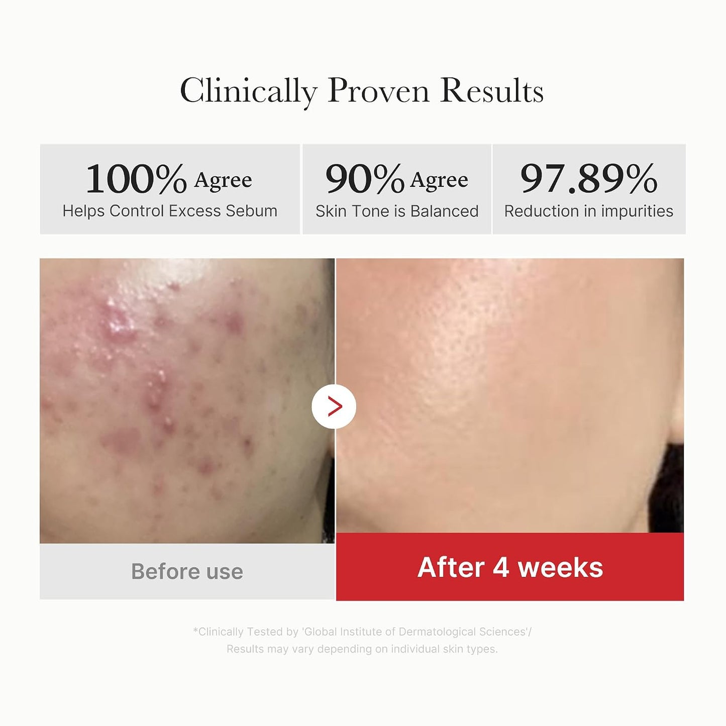 Medicube Toner Pad Collection | PDRN, Pore, Glow & Peel