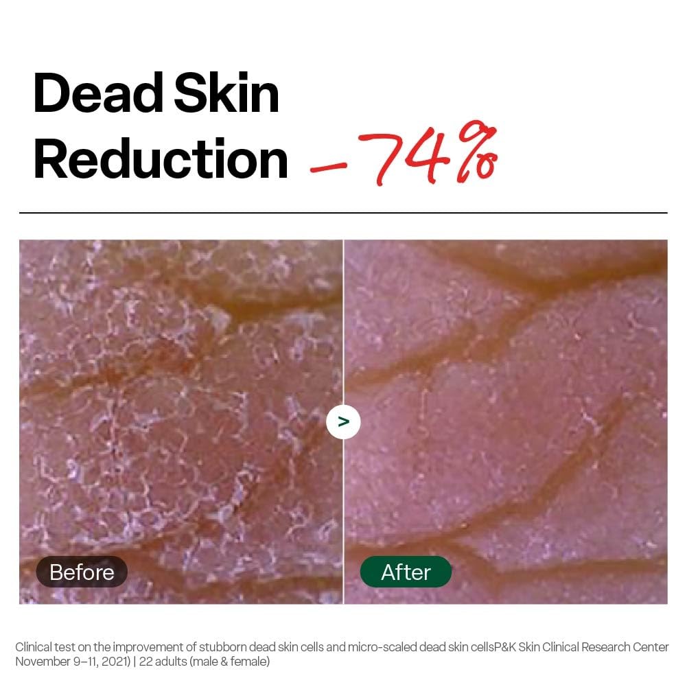 Dr. G Brightening Peeling Gel 120g – Gentle Exfoliating Gel for Dull Skin & Radiant Glow