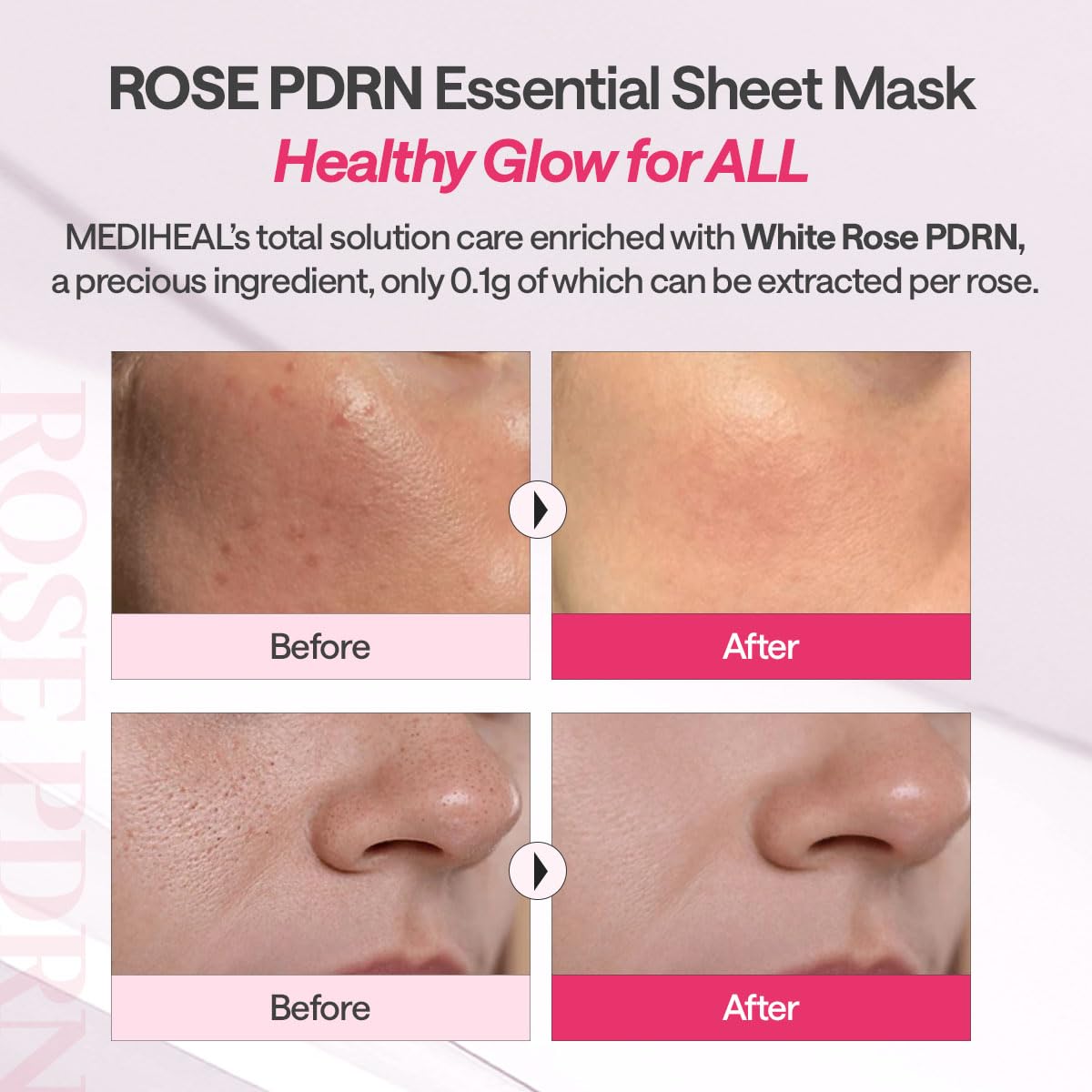 MEDIHEAL Essential Sheet Mask Collection | Korean Face Masks for Every Skin Concern (10ea Packs)