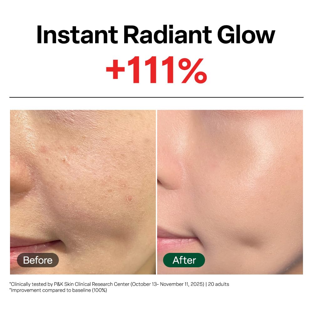 Dr. G Black Snail Cream - Korean Skincare with Snail Mucin