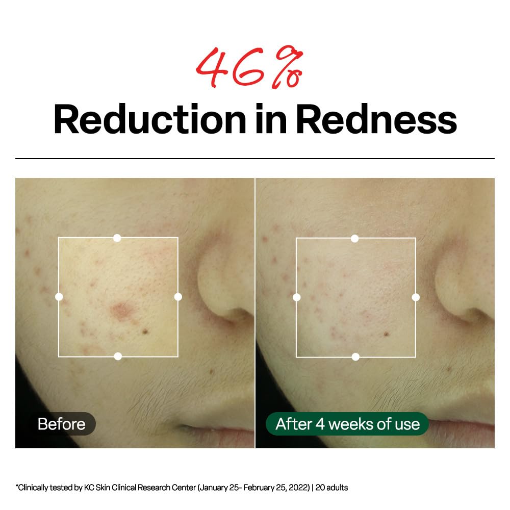 Dr. G R.E.D Blemish Clear Soothing Cream 50ml – Calming Moisturizer for Sensitive & Oily Skin