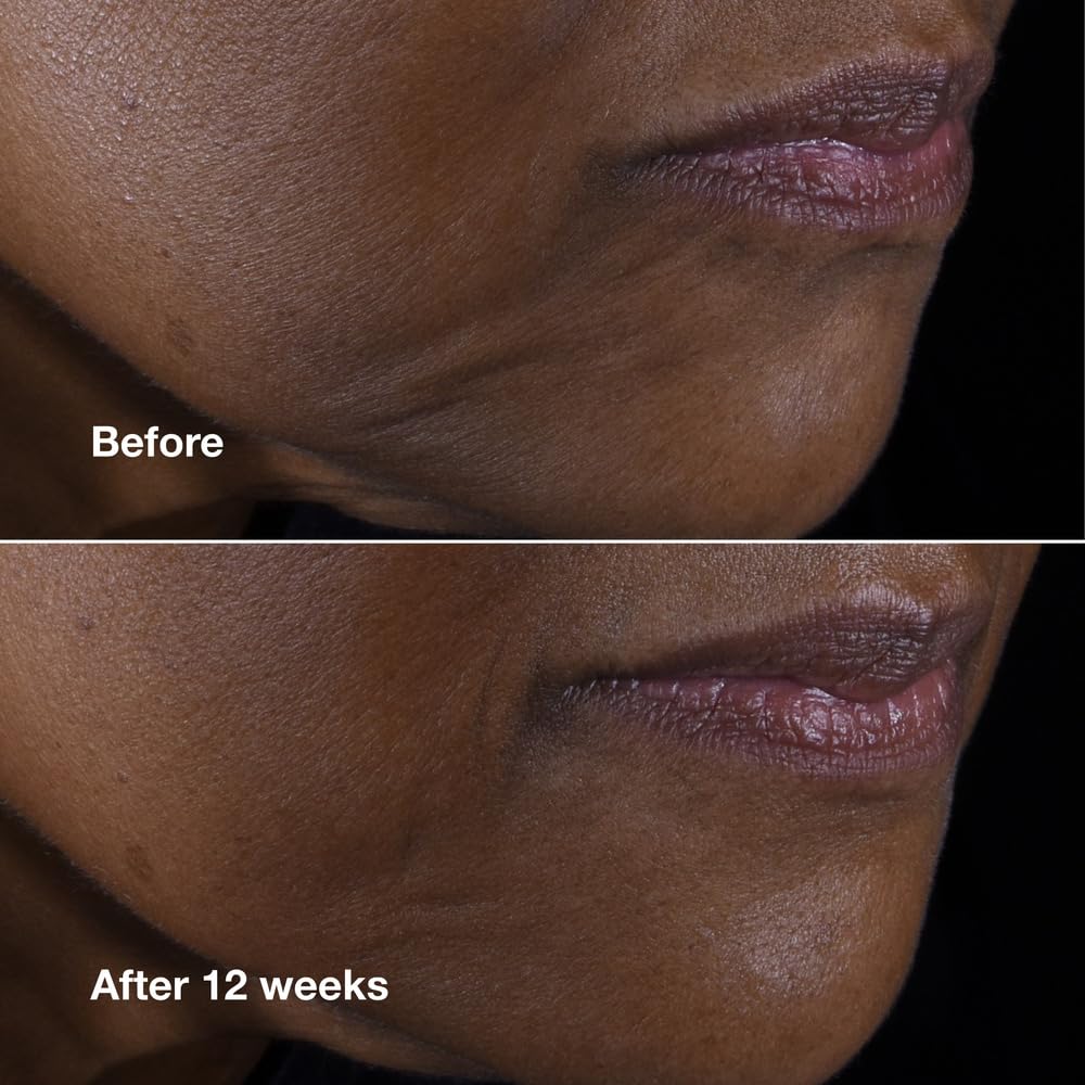Clinique Smart Clinical Repair Face + Neck Cream | Lift