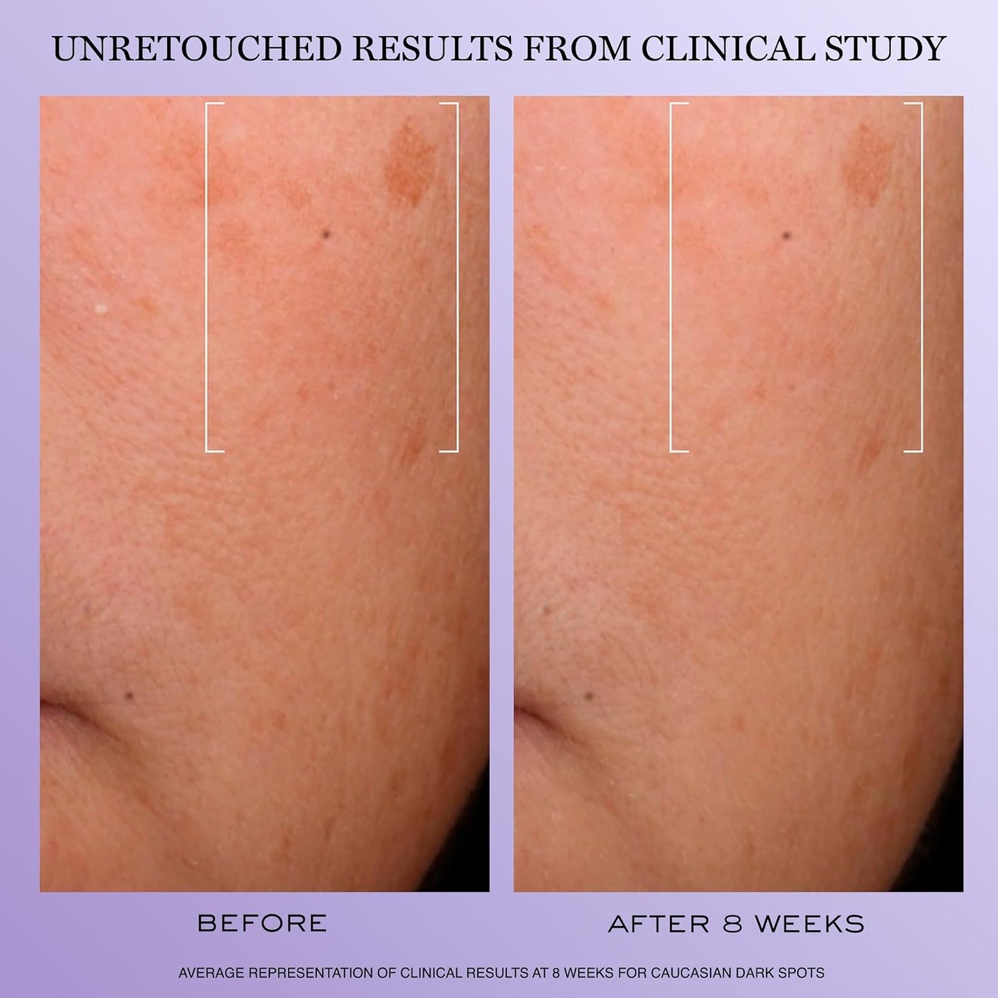 Lancôme Rénergie H.C.F. Triple Serum | Hyaluronic Acid + Vitamin C + Niacinamide Anti-Aging Serum