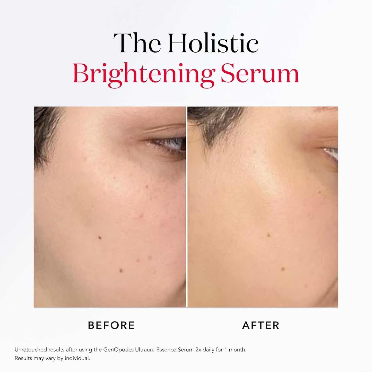 SK-II GenOptics Ultraura Essence – Advanced Brightening & Dark Spot Correcting Serum