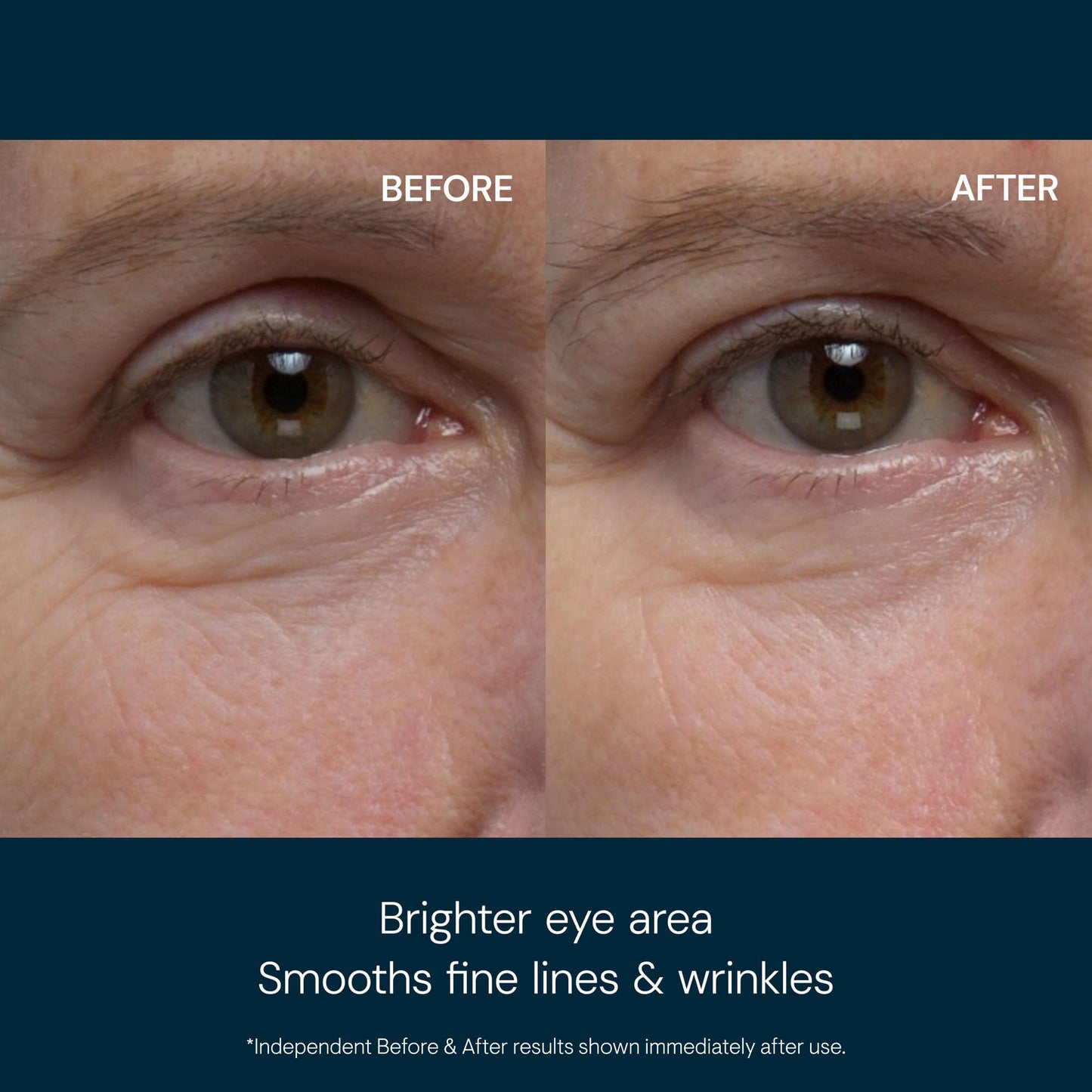 Elemis Pro-Collagen Eye Revive Mask – Cooling Anti-Aging Under Eye Treatment