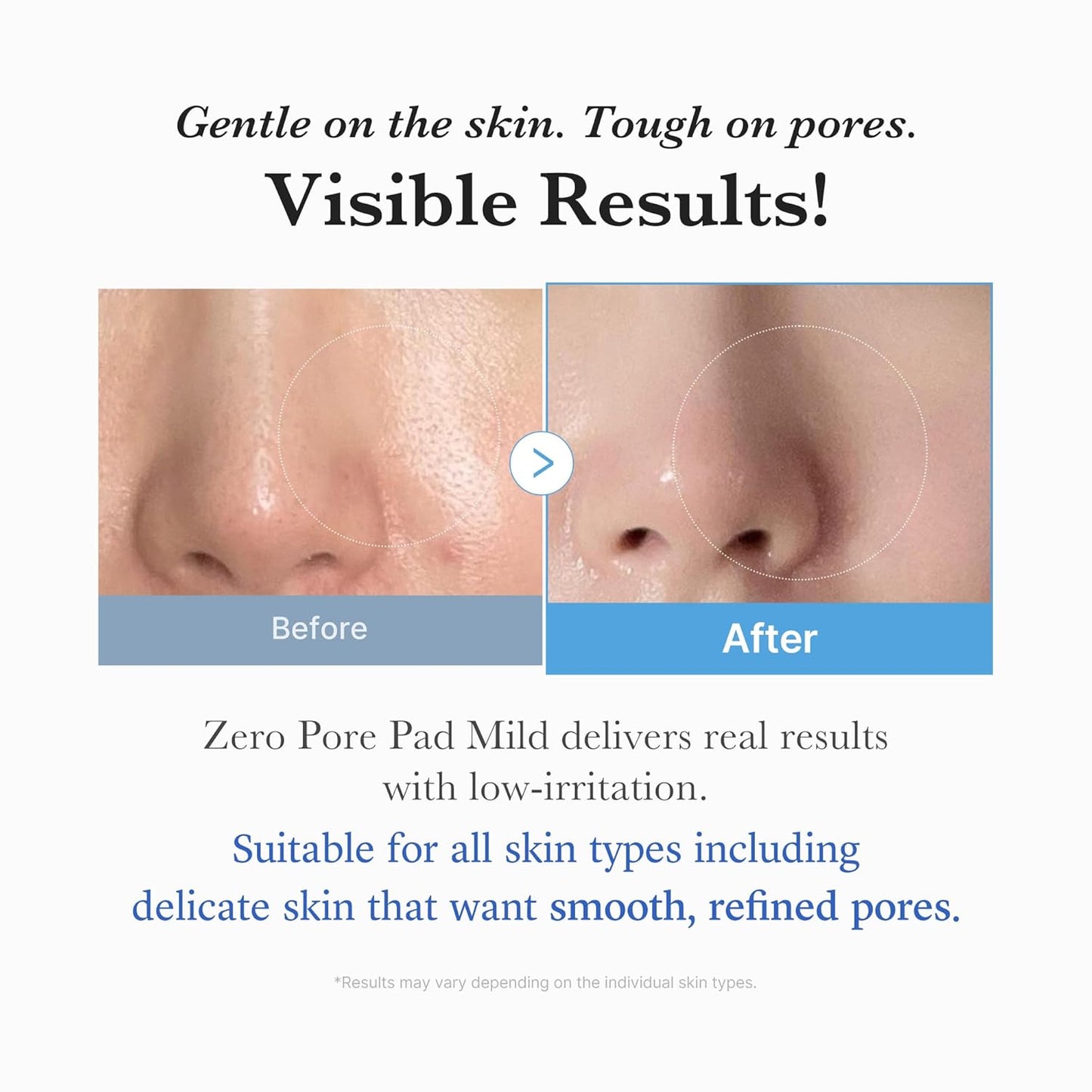 Medicube Toner Pad Collection | PDRN, Pore, Glow & Peel