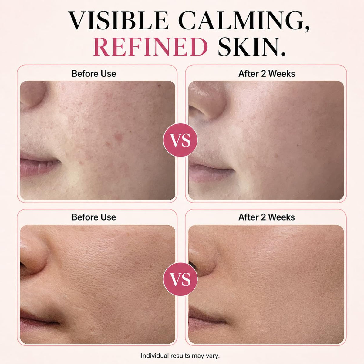 SARANG Facial Serum 30ml | Niacinamide Pink Gel Korean