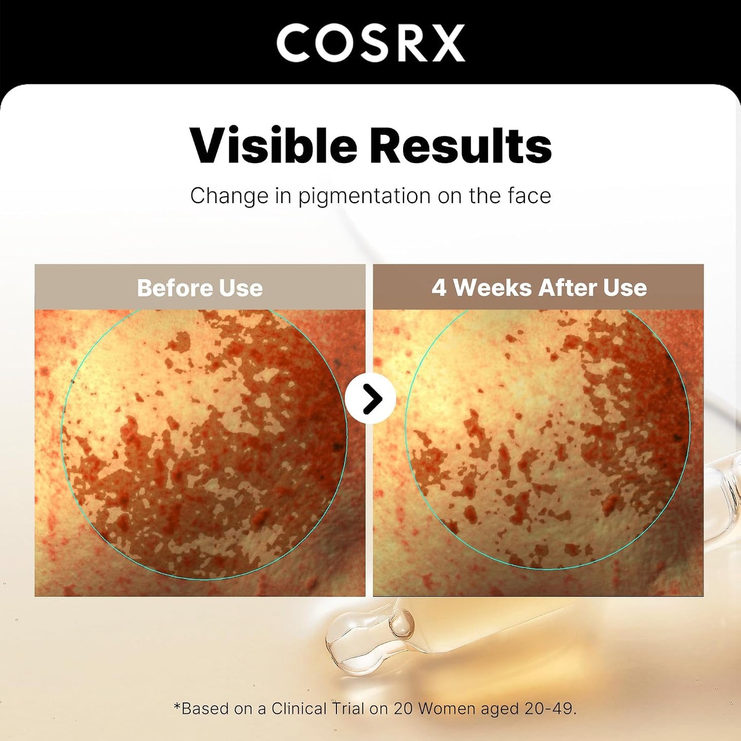 COSRX The Alpha-Arbutin 2 Discoloration Care Serum | 2% Alpha-Arbutin + 3% Tranexamic Acid for Dark Spots & PIH