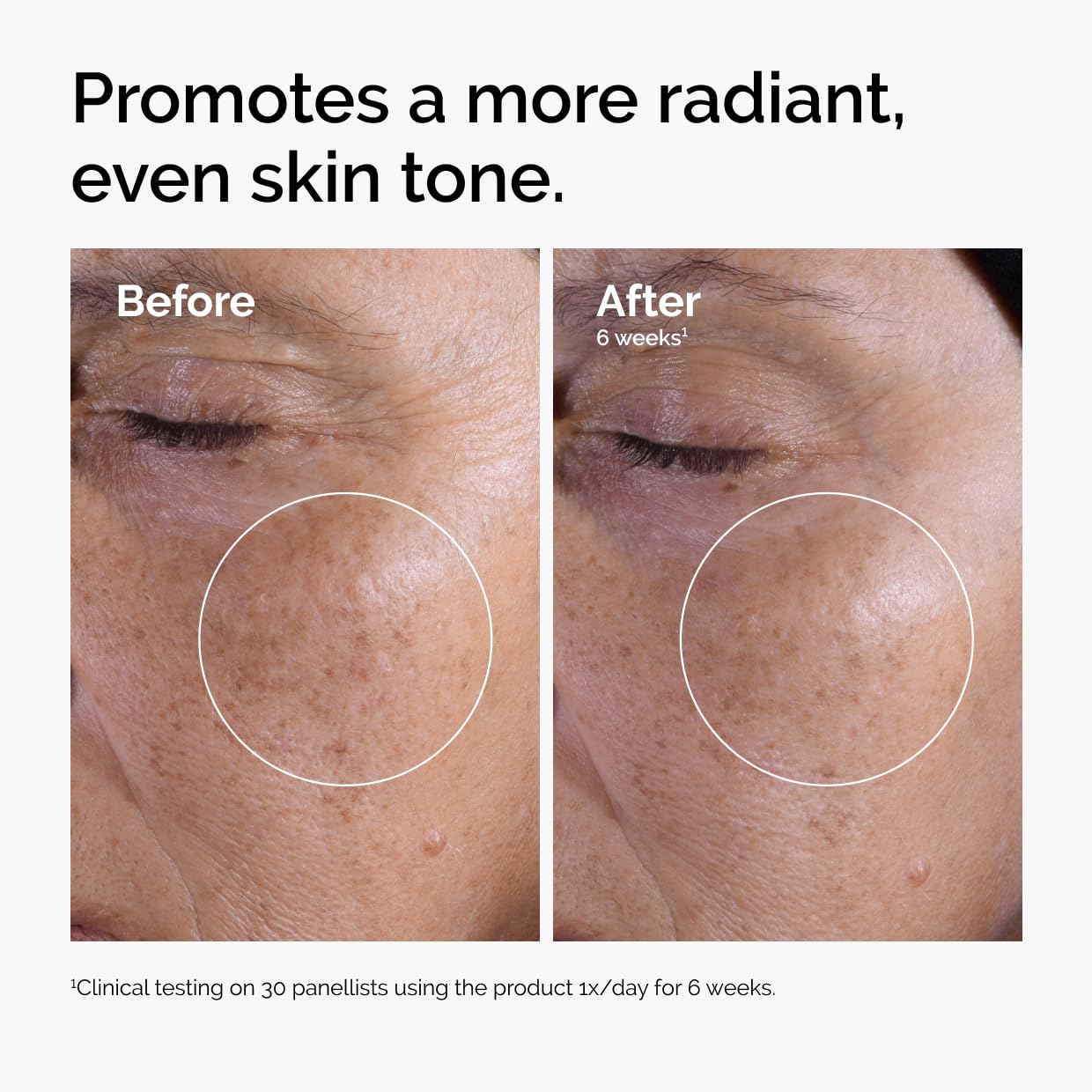 The Ordinary Glycolic Acid 7% Exfoliating Toner | Daily AHA Toner for Texture, Tone & Radiance