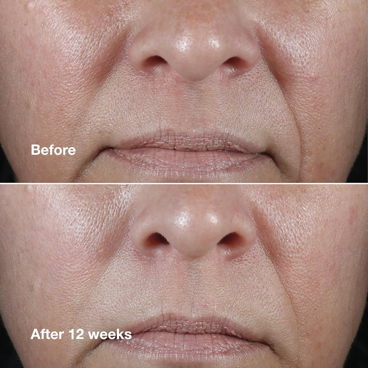 Clinique Smart Clinical Repair Rich Cream | Peptide Wrinkle