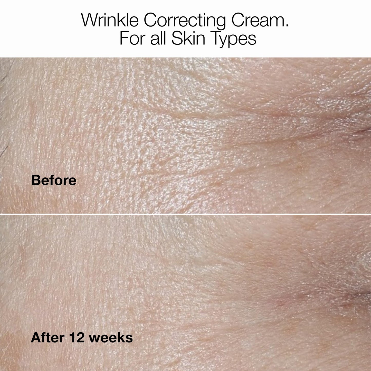 Clinique Smart Clinical Repair Collagen + PDRN Cream | Firming Moisturizer