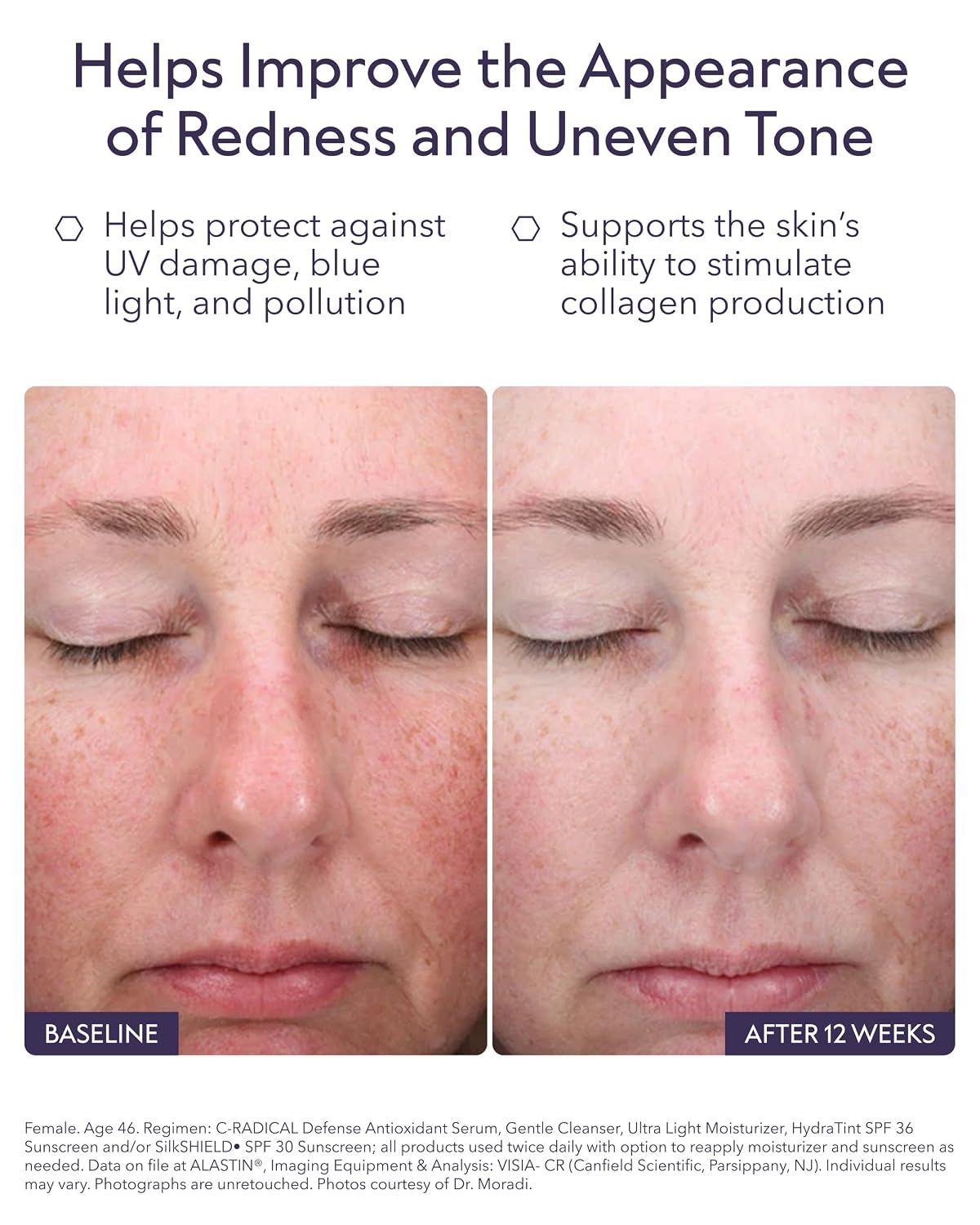 ALASTIN C-RADICAL Defense Antioxidant Serum | 1 oz