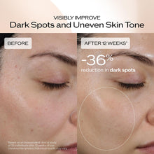 Shiseido Benefiance Dark Spot and Wrinkle Smoothing Serum – Luxury Anti-Aging Treatment