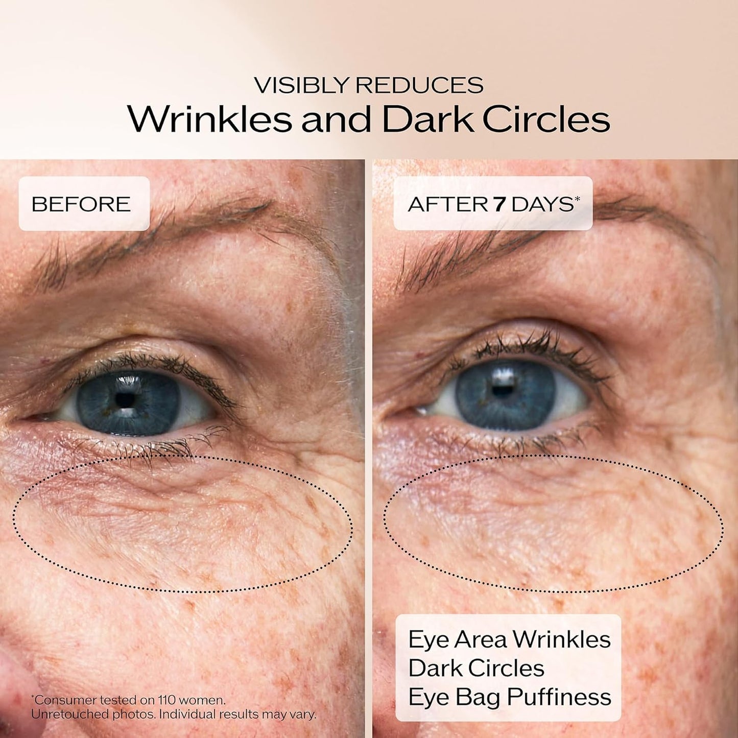 Shiseido Benefiance Wrinkle Smoothing Eye Cream – Anti-Aging Under-Eye Moisturizer