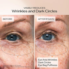 Shiseido Benefiance Wrinkle Smoothing Eye Cream – Anti-Aging Under-Eye Moisturizer