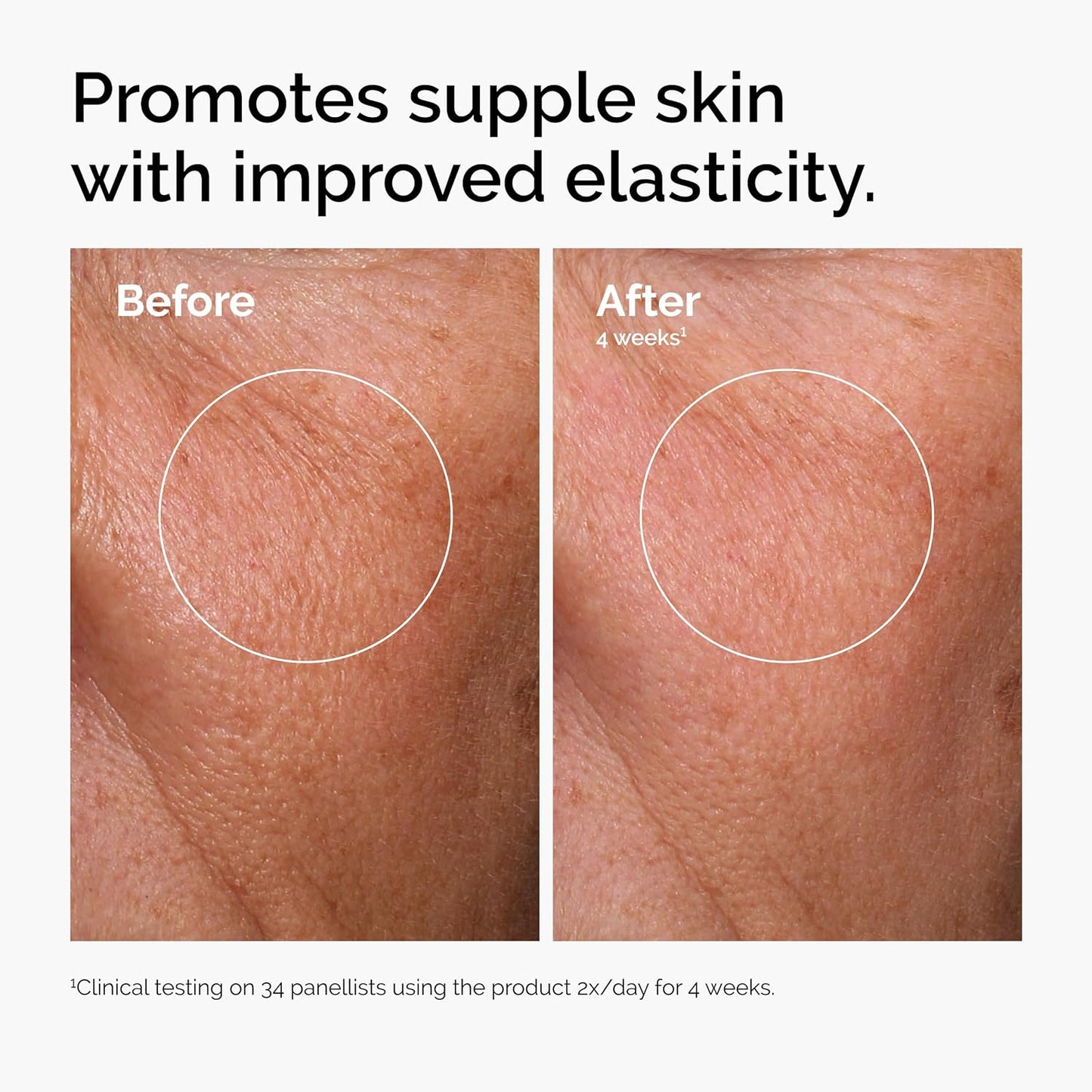 The Ordinary Hyaluronic Acid 2% + B5 | Multi-Depth Hydration Serum with Ceramides