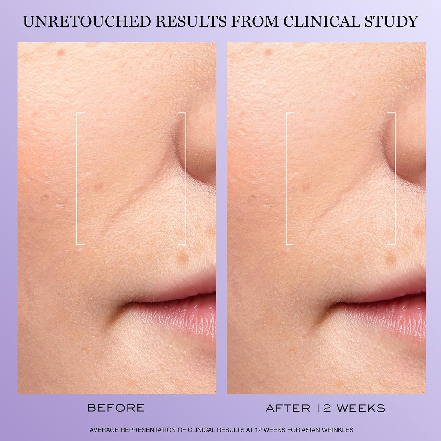 Lancôme Rénergie H.C.F. Triple Serum | Hyaluronic Acid + Vitamin C + Niacinamide Anti-Aging Serum