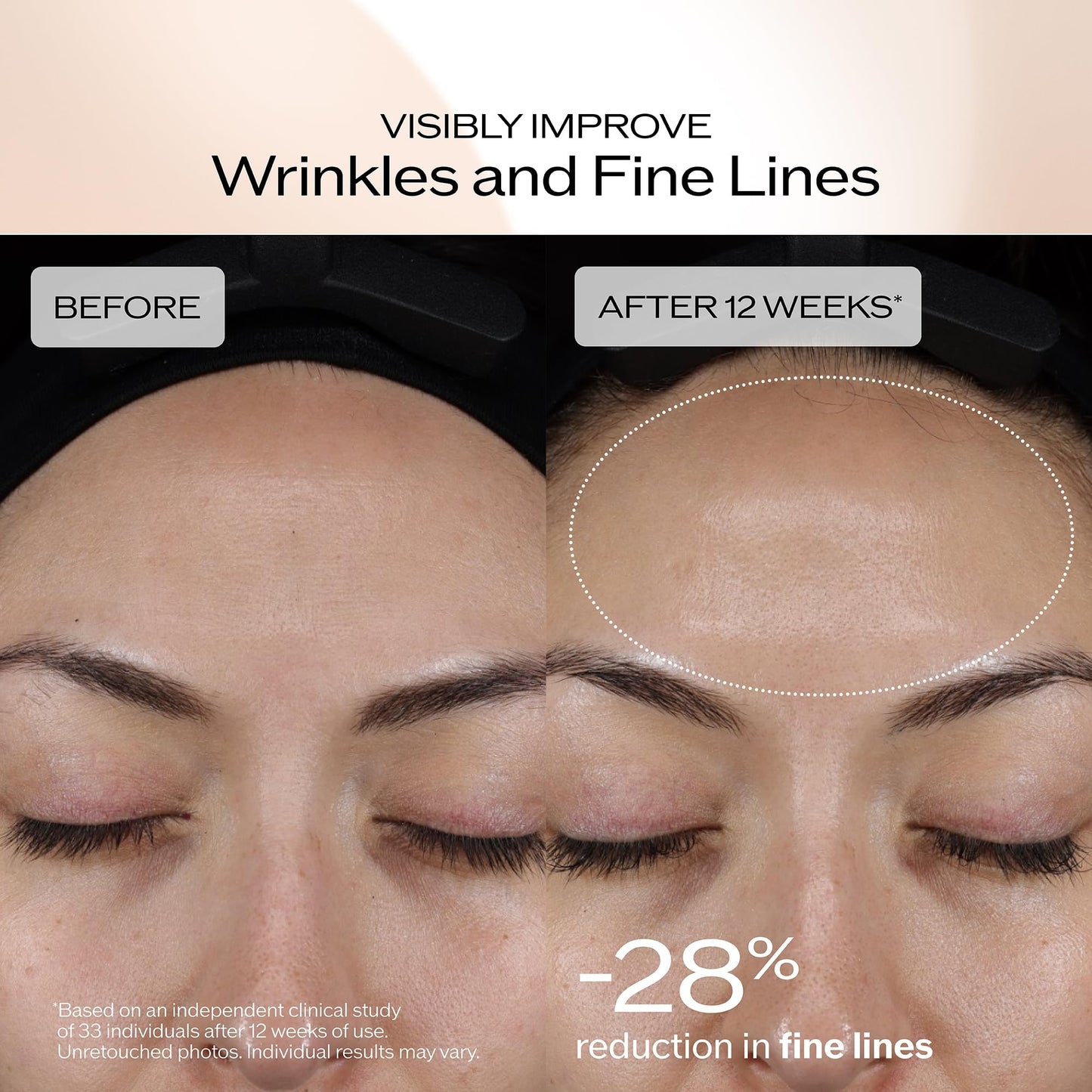 Shiseido Benefiance Dark Spot and Wrinkle Smoothing Serum – Luxury Anti-Aging Treatment