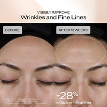 Shiseido Benefiance Dark Spot and Wrinkle Smoothing Serum – Luxury Anti-Aging Treatment