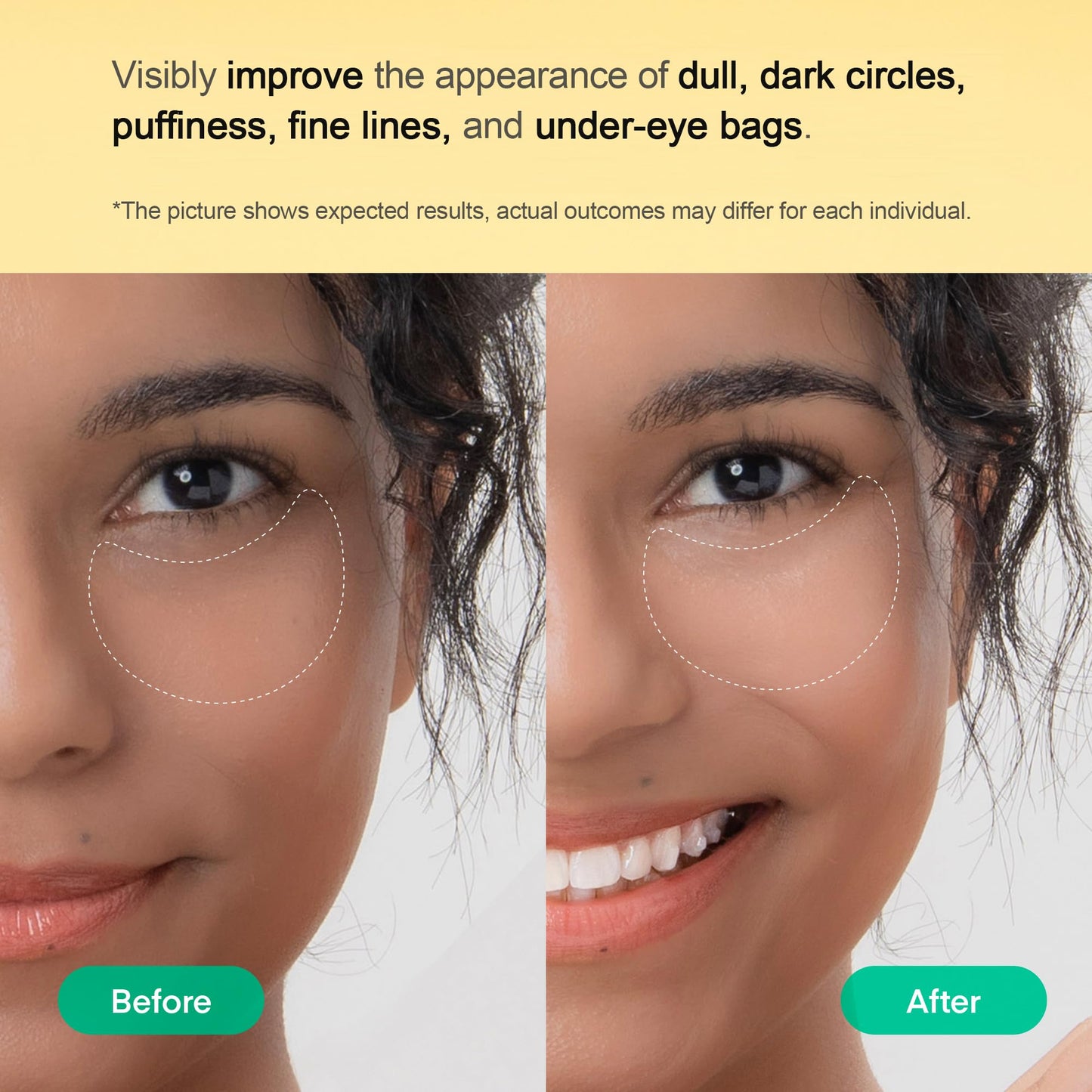 The Ultimate Eye Care Trio: Transform Your Under-Eyes with Terez & Honor Hydrogel Patches