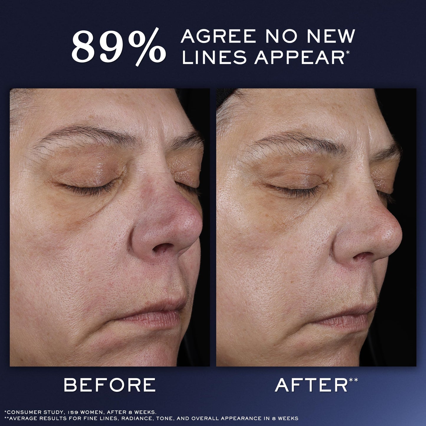 Lancôme Génifique Ultimate Serum | Advanced Skin Barrier Repair & Anti-Aging Serum