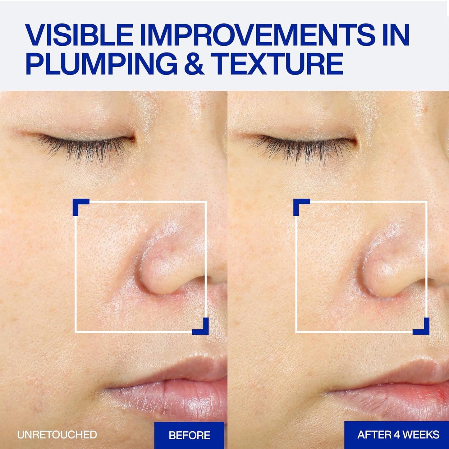IOPE XMD STEM III Clinical Recovery Serum | PDRN Plumping
